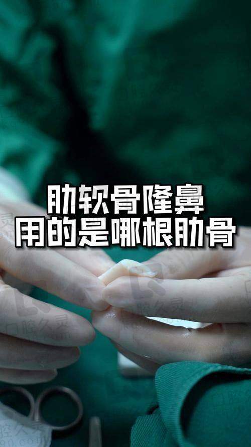 广州壹加壹美容医院李明肋软骨隆鼻15750元起,肋软骨的塑形性与支撑性较强，能够使得鼻部的线条更加优雅流畅