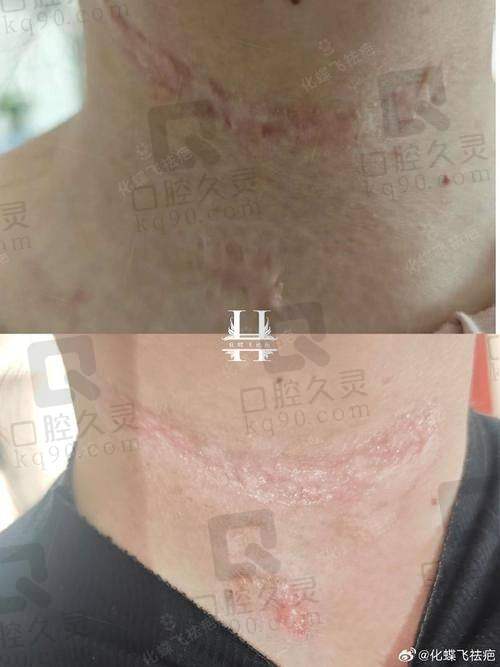 合肥花容医疗美容——精良手段与优质服务的结合
