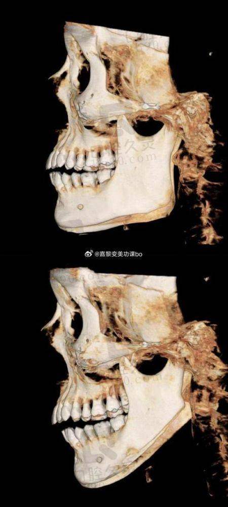 三、医院口碑如何不妨来看集美们的实例评价