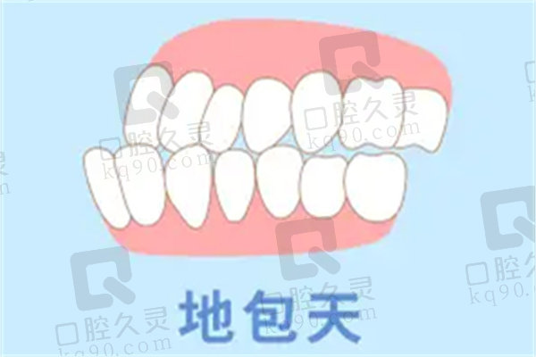 成都友谊整形地包天矫正手术45000元起，赵延峰等华西名医打造和谐美观面部轮廓