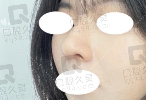 昆明娇点鼻综合医生推荐：姜宇禄、文杰、詹磊，各有专长助你美鼻无忧