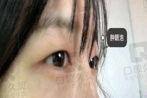 车红昌医生预约注意事项+术前准备提醒
