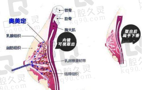 上海华美医疗美容医院——小创口清奥满意度高