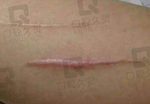王博谦医生在医美学术方面有哪些贡献？