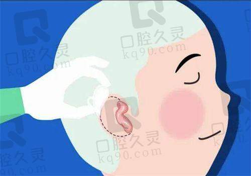 刘嘉锋舒展修复技术的优势亮点