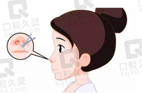 二、王先成医生擅长技术及优势