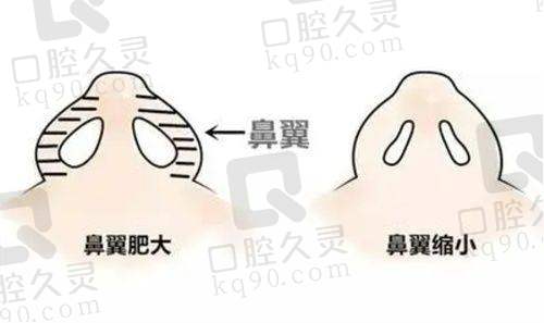 广州荔湾医院在奥美定隆胸取出修复方面有何特色？