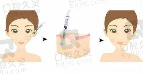 深圳做鼻子好的医生排名里郑文涛医生怎么样？