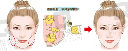 常德美莱医疗美容医院收费标准参考