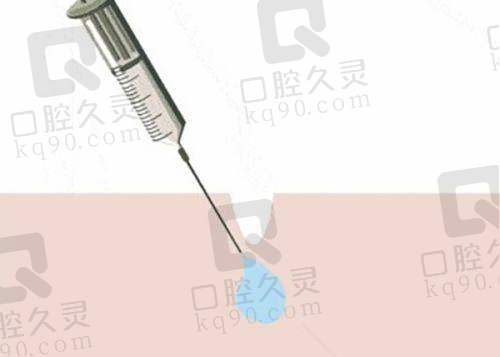 2025昆明娇点瘦脸针及填充价位