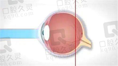 五、广西医科大学第一附属医院眼科怎么预约：