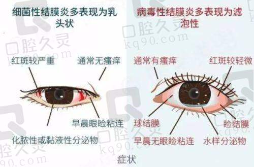 一、云南大学附属医院眼科怎么样？