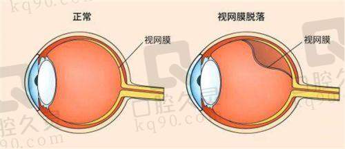 四、齐齐哈尔爱尔眼科医院怎么预约：