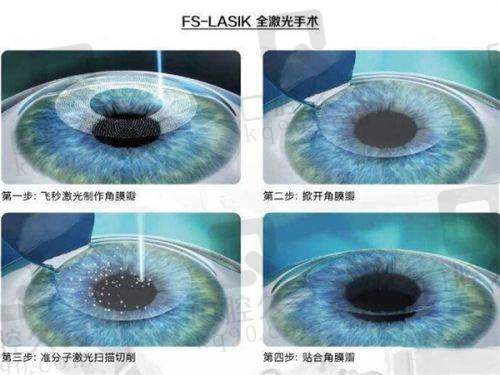 五、遵义医 科 大学附属医院眼科怎么预约：