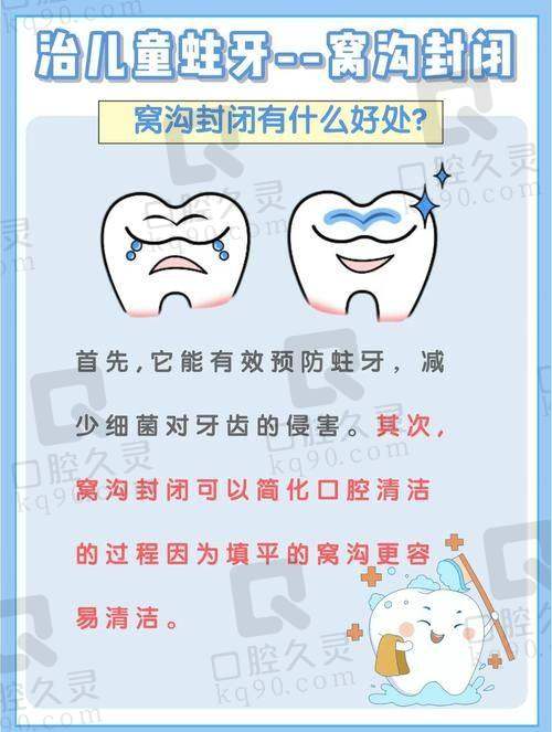 上海泰康拜博口腔美国3M儿童窝沟封闭使用的材料如何？
