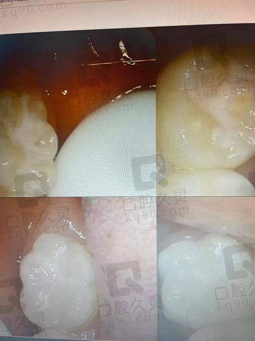 上海泰康拜博口腔还有哪些其他的儿童口腔项目及价格？