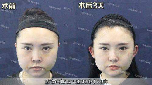三、患者口碑与实例分享
