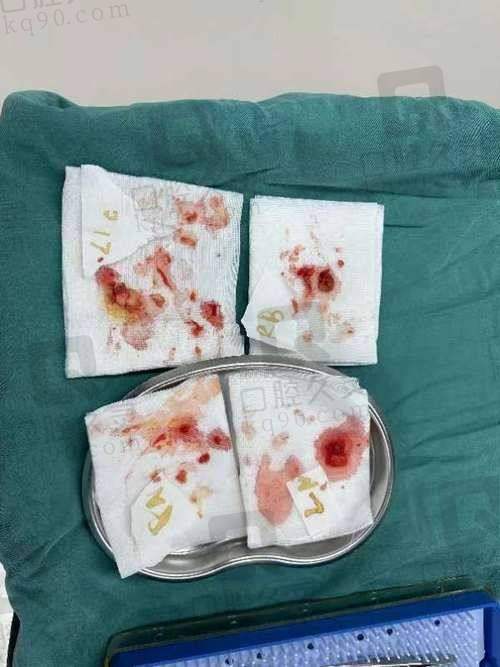 深圳今喜整形医院——专注清奥经验多