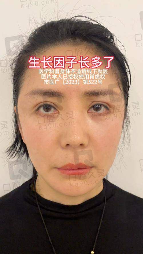 吴贞跃手术价格及预约方式