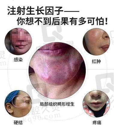 吴贞跃手术成功几率的数据支撑