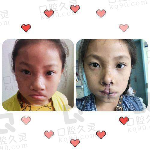 超全攻略：怎么咨询陈国鼎教授唇裂问题，从预约到方案制定一步到位