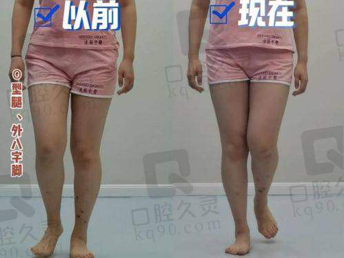 总结