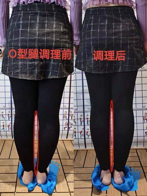 五、陕西省人民医院 - 整形外科