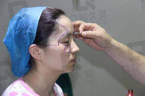 辽宁曙光整形医院面部脂肪填充体验，饱满童颜轻松get，术后恢复快效果超自然 