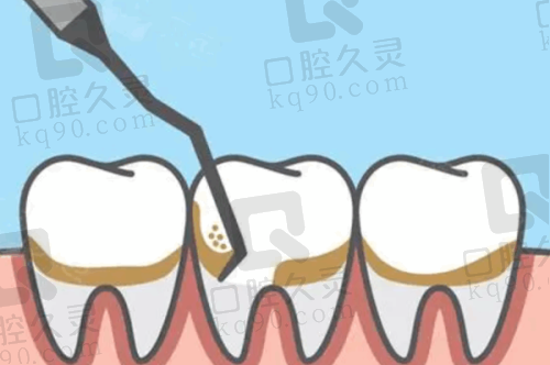 温馨服务：让看牙变成享受