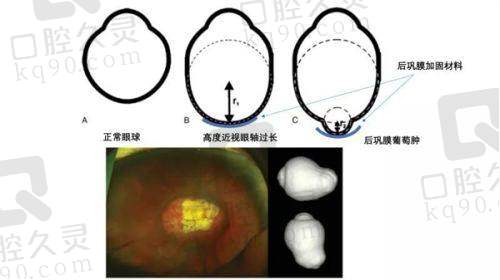 哈尔滨普瑞眼科医院斜弱视医生推荐