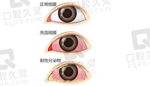 贵阳爱尔眼科医院的背景实力如何？