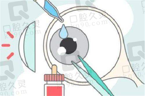 赣州普瑞眼科医院做激光手术是哪个医生？雷鸣、许小毛院长做近视激光矫正手术备受认可
