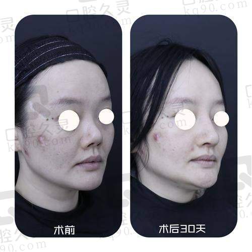 整形医生田夫的特色技术