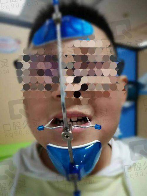 为什么要选择儿童早期干预矫正？