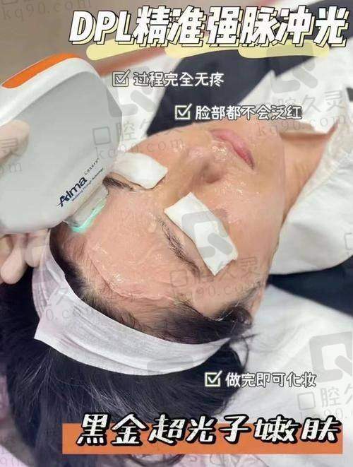 光子嫩肤真的有用吗？揭秘其改善肌肤暗沉、细纹、色斑的神奇功效 