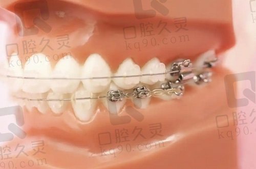 天津爱之和的刘承从业经历：天津医科大学毕业，超2000例美学矫正病例太牛！