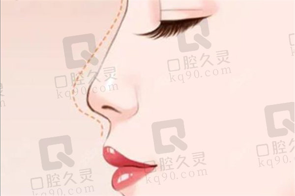 成都黄开亮医生简介和预约挂号指南你知道吗?鼻部整形行家口碑好速来约!
