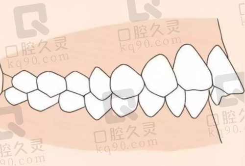 北碚摩尔口腔地址及预约方式