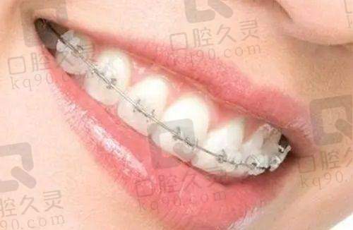 深圳卫佳康口腔：设备精良价格实惠