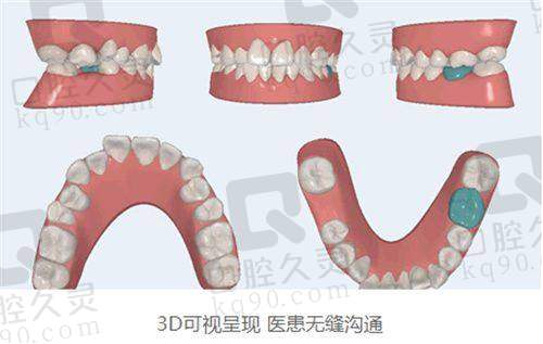 五、烟台白玉口腔医院刘大玮医生：解决“种牙难”问题能手