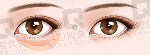 北京岩之畔医巢医疗美容门诊部口碑如何？