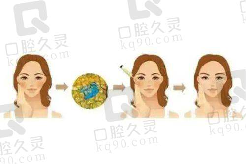 北京小忠丽格轻医疗美容门诊部技术好不好？