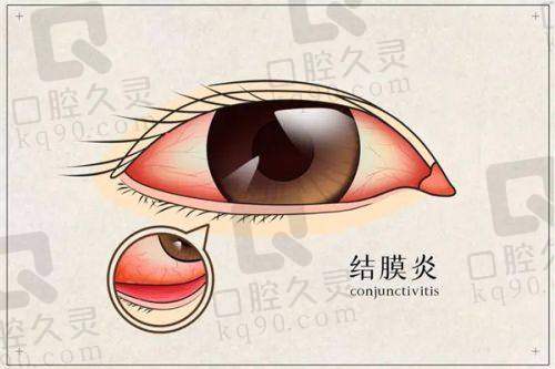 常德爱尔眼科医院技术好不好？
