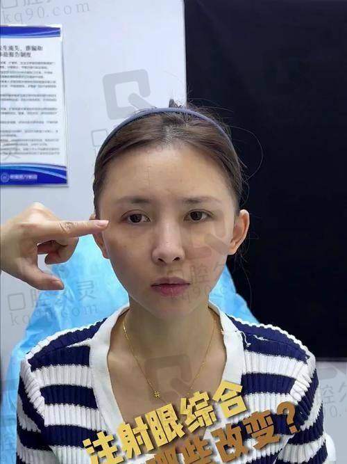 赵江辉医生：审美细腻，注重輪廓衔接与自然过渡