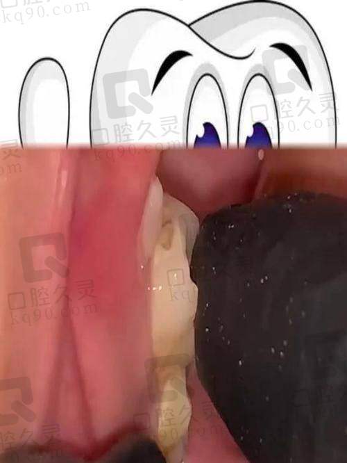 西宁中诺口腔医院乳牙拔除53元起，无痛操作减轻孩子看牙恐惧！ 