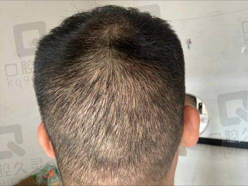 七、南宁瑞丝华美植发地址及交通