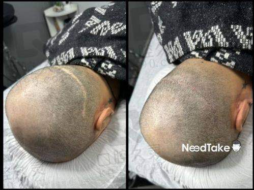 五、广州碧莲盛植发怎么预约: