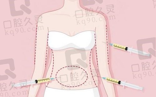 想找重庆孔令杰医生做吸脂？他在新铜雀台坐诊，成功实例超多
