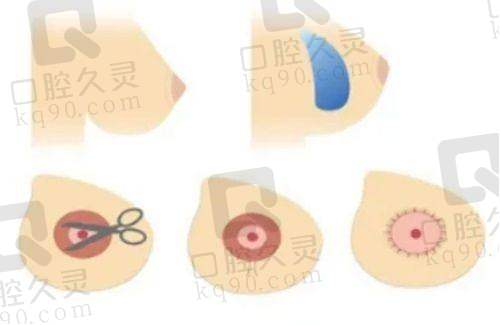 芜湖美高美医疗美容诊所患者评价：
