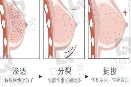 曼托：经济实用的选择